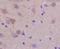 Ret Proto-Oncogene antibody, orb100148, Biorbyt, Immunohistochemistry paraffin image 