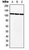 Myocardin Related Transcription Factor B antibody, LS-C353845, Lifespan Biosciences, Western Blot image 