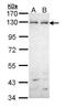 HEP antibody, GTX111340, GeneTex, Western Blot image 
