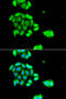 DNA repair protein RAD51 homolog 4 antibody, 23-011, ProSci, Immunofluorescence image 