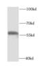 Succinyl-CoA:3-ketoacid-coenzyme A transferase 1, mitochondrial antibody, FNab06050, FineTest, Western Blot image 