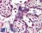 HsMAD2 antibody, LS-B2063, Lifespan Biosciences, Immunohistochemistry paraffin image 