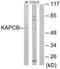cAMP-dependent protein kinase catalytic subunit beta antibody, TA314382, Origene, Western Blot image 