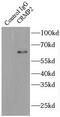 Dihydropyrimidinase Like 2 antibody, FNab01987, FineTest, Immunoprecipitation image 