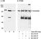 Cap Methyltransferase 1 antibody, A300-305A, Bethyl Labs, Immunoprecipitation image 