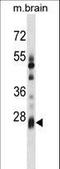 Potassium Channel Tetramerization Domain Containing 6 antibody, LS-C165461, Lifespan Biosciences, Western Blot image 
