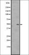 Somatostatin Receptor 3 antibody, orb335588, Biorbyt, Western Blot image 