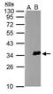 Zinc finger and BTB domain-containing protein 32 antibody, PA5-30521, Invitrogen Antibodies, Western Blot image 