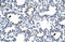 Cbp/P300 Interacting Transactivator With Glu/Asp Rich Carboxy-Terminal Domain 1 antibody, ARP32705_P050, Aviva Systems Biology, Immunohistochemistry paraffin image 