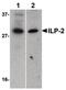Baculoviral IAP Repeat Containing 8 antibody, PA5-19999, Invitrogen Antibodies, Western Blot image 