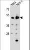 Aspartyl Aminopeptidase antibody, LS-C167498, Lifespan Biosciences, Western Blot image 