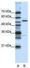 Zinc finger protein 655 antibody, TA345382, Origene, Western Blot image 