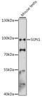 SUN domain-containing protein 1 antibody, 16-382, ProSci, Western Blot image 