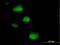 Sjoegren syndrome nuclear autoantigen 1 antibody, H00008636-B01P, Novus Biologicals, Immunofluorescence image 