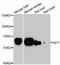 Alpha Fetoprotein antibody, MBS125057, MyBioSource, Western Blot image 