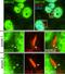 Bardet-Biedl Syndrome 10 antibody, 12421-2-AP, Proteintech Group, Immunofluorescence image 