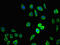 Zinc Finger DHHC-Type Containing 1 antibody, CSB-PA837848LA01HU, Cusabio, Immunofluorescence image 