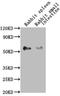 CD14 antibody, LS-C763563, Lifespan Biosciences, Western Blot image 