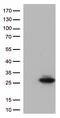 Cancer/Testis Antigen 1B antibody, CF505953, Origene, Western Blot image 