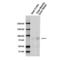 Sodium Channel Epithelial 1 Alpha Subunit antibody, SPC-403D-PCP, StressMarq, Western Blot image 