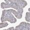 Zinc Finger CCCH-Type Containing 6 antibody, PA5-57495, Invitrogen Antibodies, Immunohistochemistry frozen image 