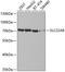 Solute carrier family 22 member 8 antibody, A04087, Boster Biological Technology, Western Blot image 