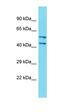 DDB1 And CUL4 Associated Factor 4 Like 2 antibody, orb326960, Biorbyt, Western Blot image 