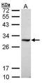 Dimethylarginine Dimethylaminohydrolase 1 antibody, TA309004, Origene, Western Blot image 