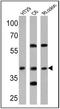 Cannabinoid Receptor 2 antibody, GTX23561, GeneTex, Western Blot image 