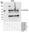 Lamina-associated polypeptide 2, isoform beta antibody, A304-840A, Bethyl Labs, Immunoprecipitation image 