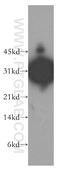 Orthodenticle Homeobox 2 antibody, 13497-1-AP, Proteintech Group, Western Blot image 