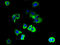 Polycystin 2 Like 2, Transient Receptor Potential Cation Channel antibody, A67762-100, Epigentek, Immunofluorescence image 