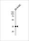 NK1 Homeobox 1 antibody, PA5-35083, Invitrogen Antibodies, Western Blot image 