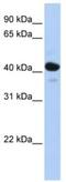 Hydroxysteroid 11-Beta Dehydrogenase 2 antibody, ab80317, Abcam, Western Blot image 