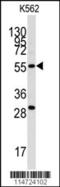 Chloride intracellular channel protein 5 antibody, 63-014, ProSci, Western Blot image 