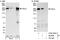 Citron Rho-interacting kinase antibody, A302-303A, Bethyl Labs, Western Blot image 