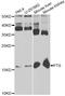 6-Pyruvoyltetrahydropterin Synthase antibody, STJ28228, St John