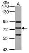 N-Acetyl-Alpha-Glucosaminidase antibody, PA5-30097, Invitrogen Antibodies, Western Blot image 