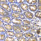 Bone Morphogenetic Protein Receptor Type 1B antibody, A2005, ABclonal Technology, Immunohistochemistry paraffin image 