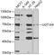 UDP Glucuronosyltransferase Family 1 Member A4 antibody, 19-725, ProSci, Western Blot image 