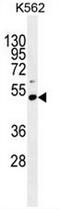 PRAME Family Member 10 antibody, AP53430PU-N, Origene, Western Blot image 
