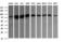 CD22 Molecule antibody, M01572-4, Boster Biological Technology, Western Blot image 