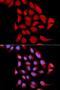 Proteasome Subunit Alpha 6 antibody, LS-C335212, Lifespan Biosciences, Immunofluorescence image 