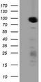 Protein Kinase D2 antibody, CF501648, Origene, Western Blot image 