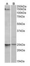 RNA Binding Motif Protein 20 antibody, orb125077, Biorbyt, Western Blot image 