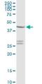 CXADR Ig-Like Cell Adhesion Molecule antibody, H00001525-D01P, Novus Biologicals, Western Blot image 
