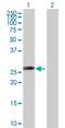 1-Acylglycerol-3-Phosphate O-Acyltransferase 1 antibody, H00010554-B01P, Novus Biologicals, Western Blot image 