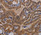 Malignant T cell-amplified sequence 1 antibody, MBS2518327, MyBioSource, Immunohistochemistry paraffin image 