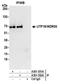 UTP18 Small Subunit Processome Component antibody, A301-552A, Bethyl Labs, Immunoprecipitation image 