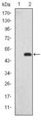 DLG Associated Protein 1 antibody, M08230, Boster Biological Technology, Western Blot image 